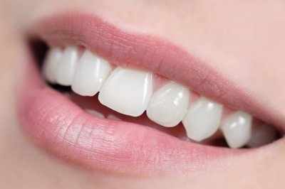 Народные средства для восстановления зубной эмали
